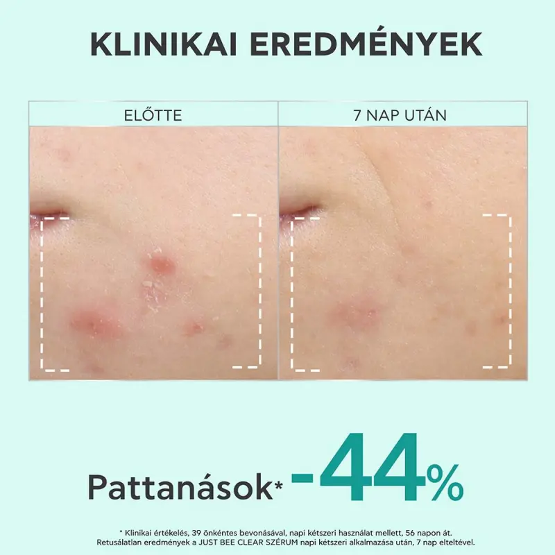JUST BEE CLEAR Szérum bőrhibák ellen (30 ml)