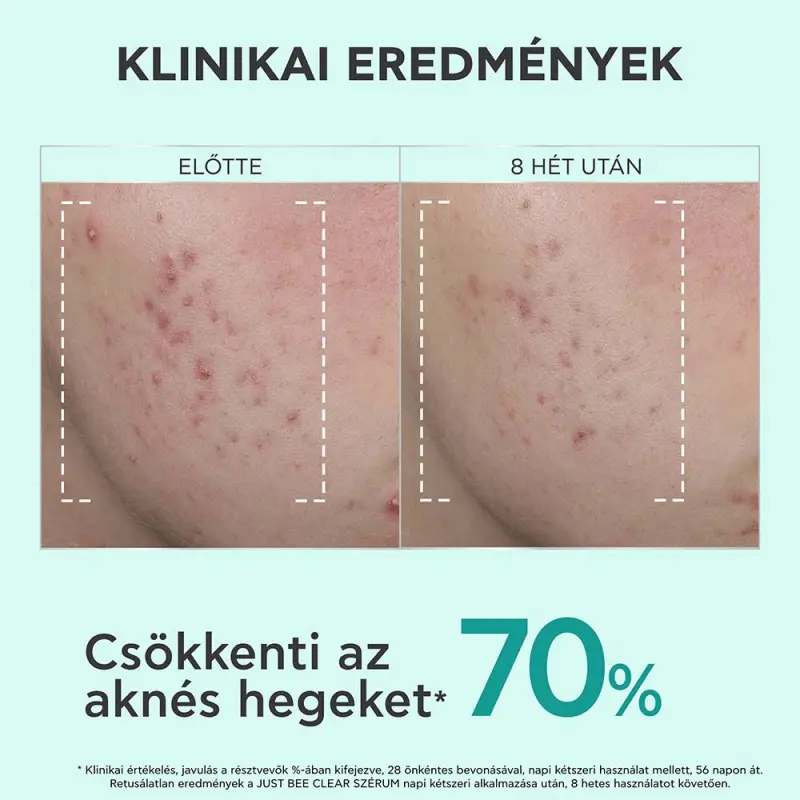 JUST BEE CLEAR Szérum bőrhibák ellen (30 ml)
