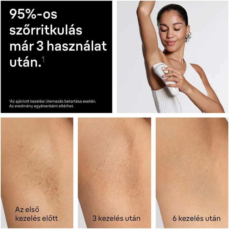 Silk-Expert IPL PL5351 Villanófényes szőrtelenítő