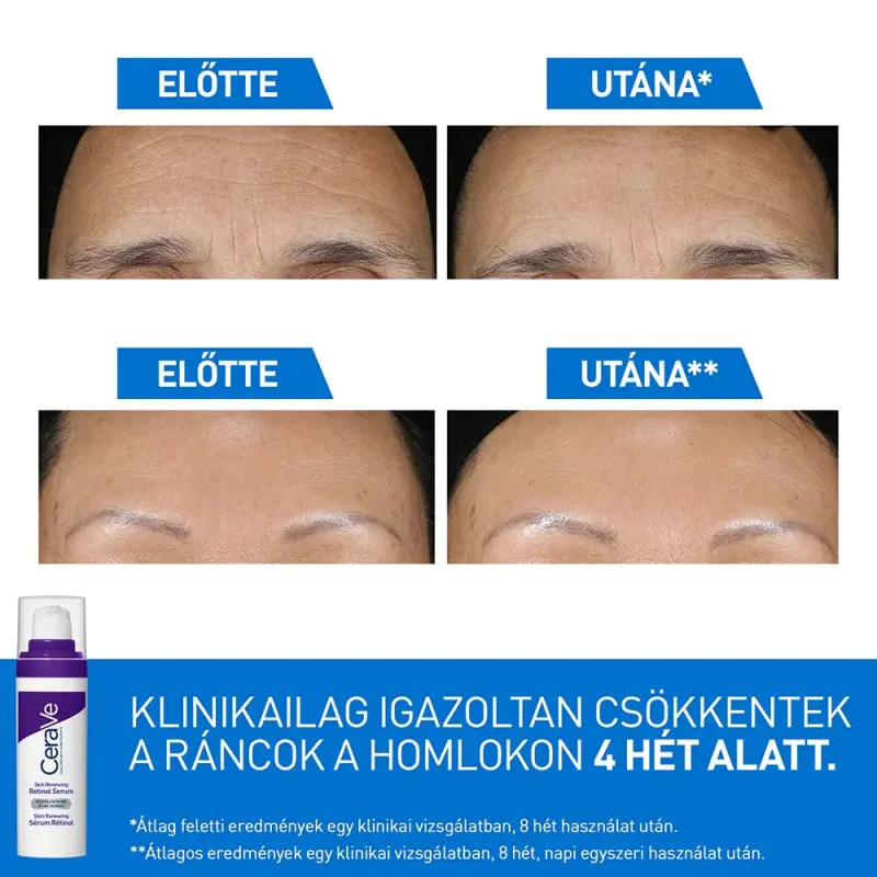 Bőrmegújító Retinol Szérum 30 ml