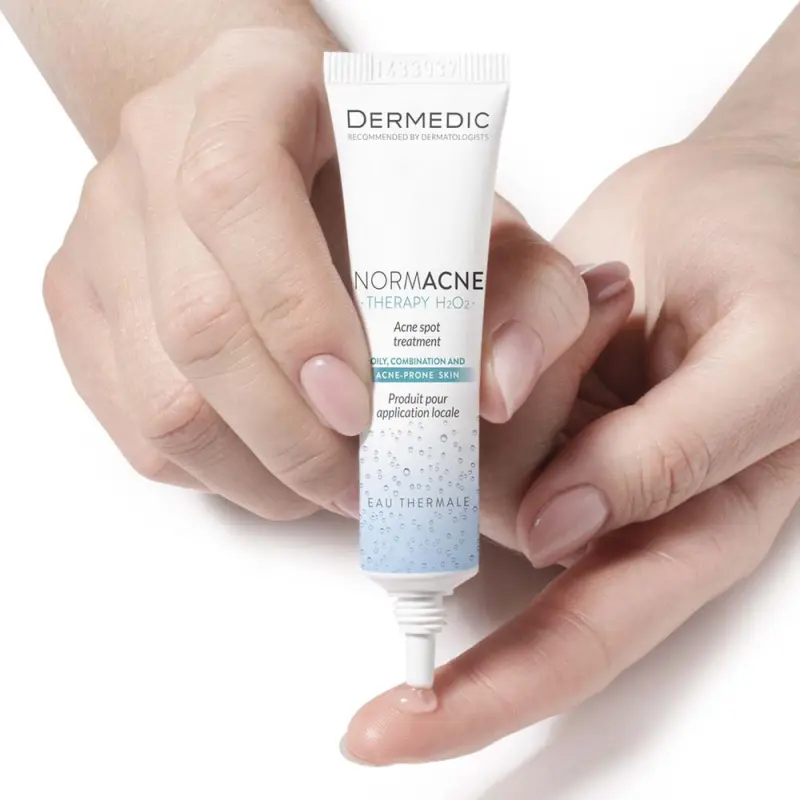 Normacne Pattanás elleni helyi kezelés 15 ml