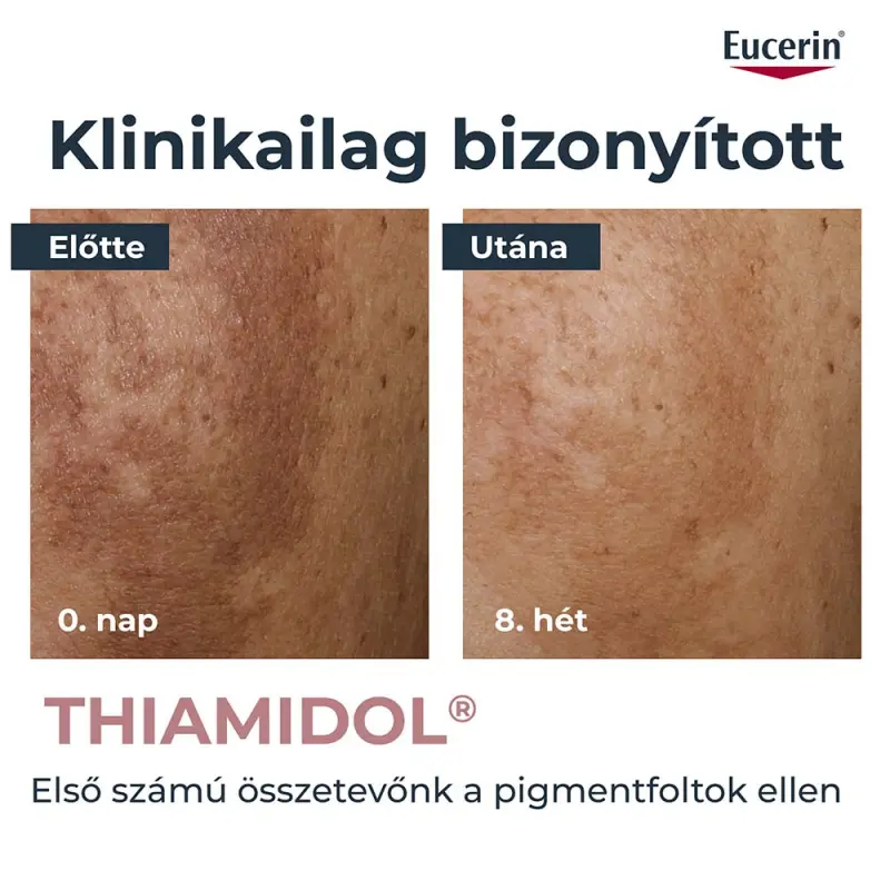 Anti-Pigment bőrtökéletesítő szérum (30 ml)