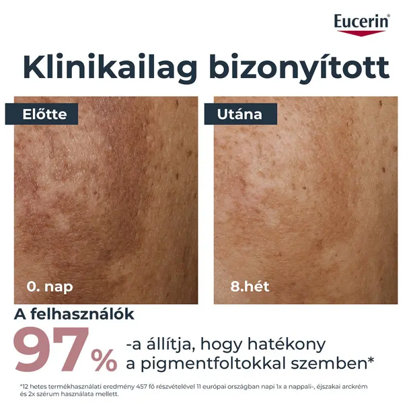 Anti-Pigment Éjszakai arckrém 50 ml