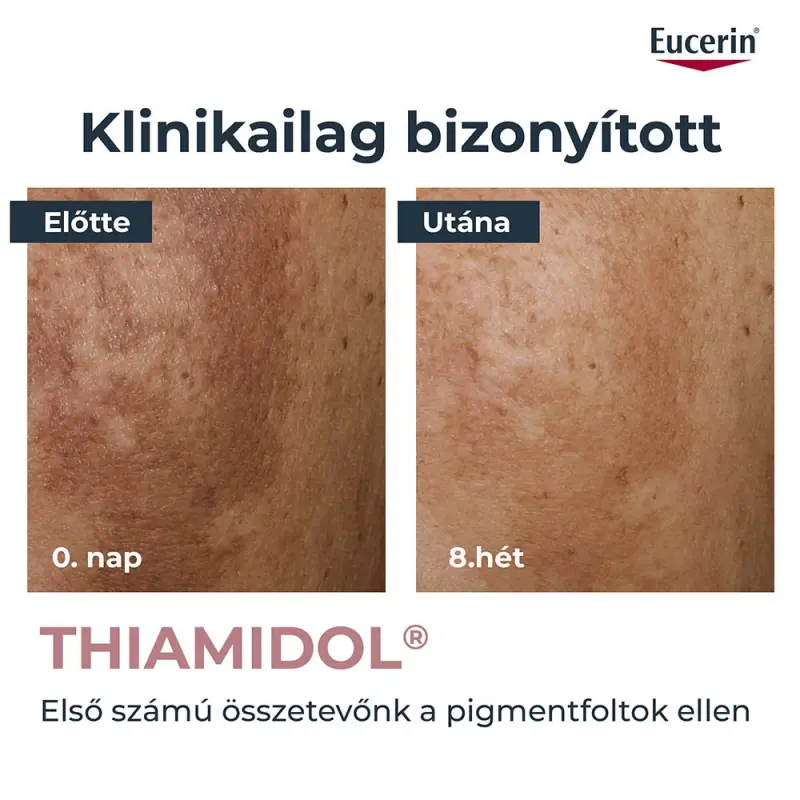 Anti-Pigment Korrektor stift 5 ml
