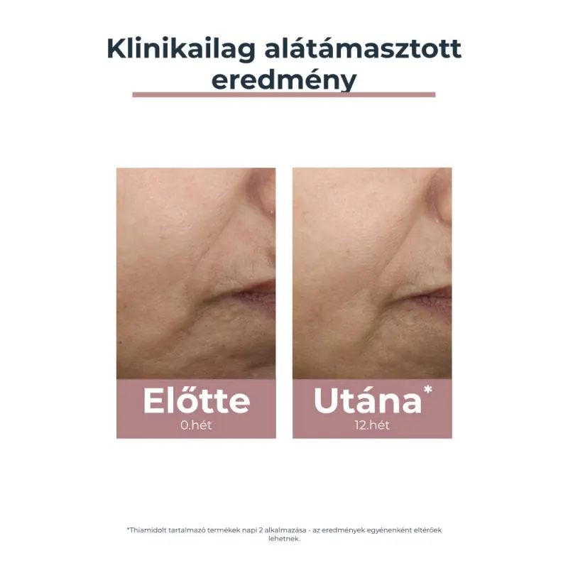 Anti-Pigment színezett nappali arckrém medium SPF30 (50 ml)