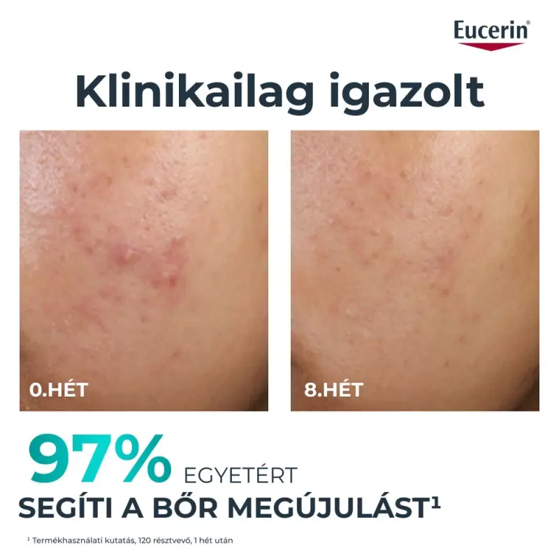 DermoPure Clinical Peeling 10 - Bőrmegújító szérum 40 ml