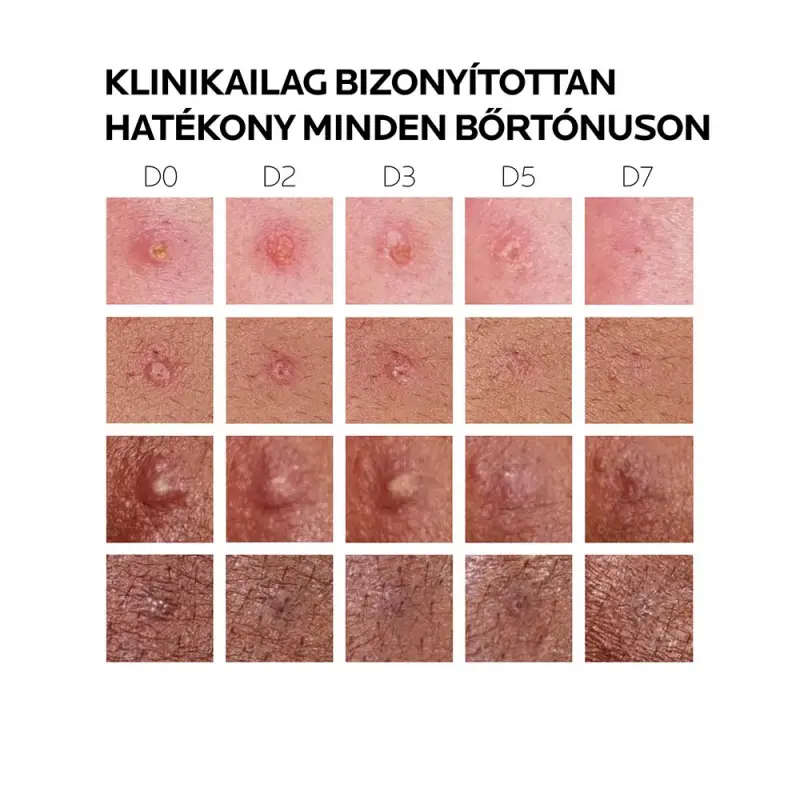 Effaclar Duo (+) M Hármas korrekciós bőrápoló bőrhibák ellen 40 ml
