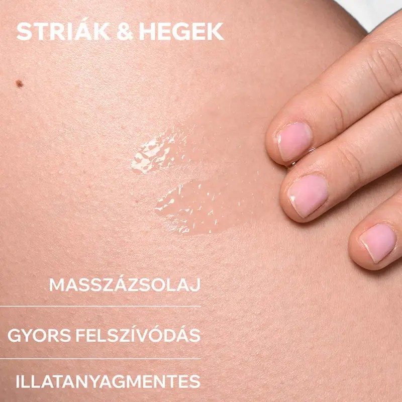 BARIÉDERM bőrgyógyászati masszázsolaj striák ellen 100 ml