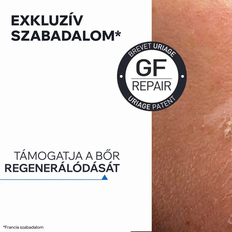 BARIÉDERM bőrgyógyászati masszázsolaj striák ellen 100 ml