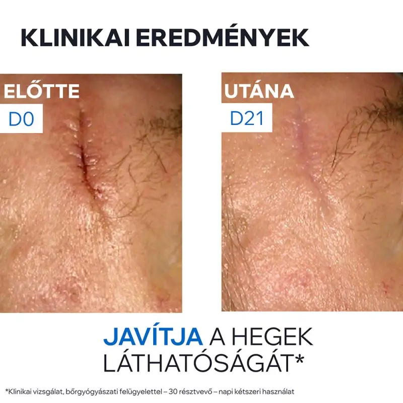 BARIÉDERM CICA CU-ZN+ Sebkezelő és gyulladáscsökkentő krém 100 ml