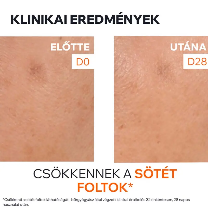 DÉPIDERM Barna foltok elleni szérum ragyogást fokozó booster 30 ml