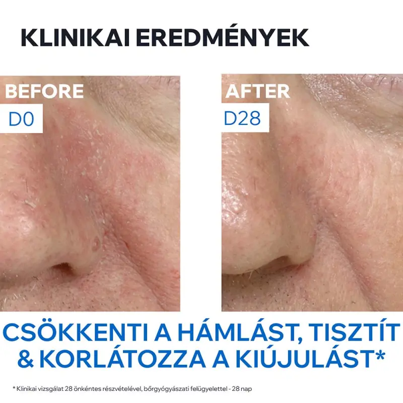 D.S. emulzió krém seborrheás bőrre 40 ml