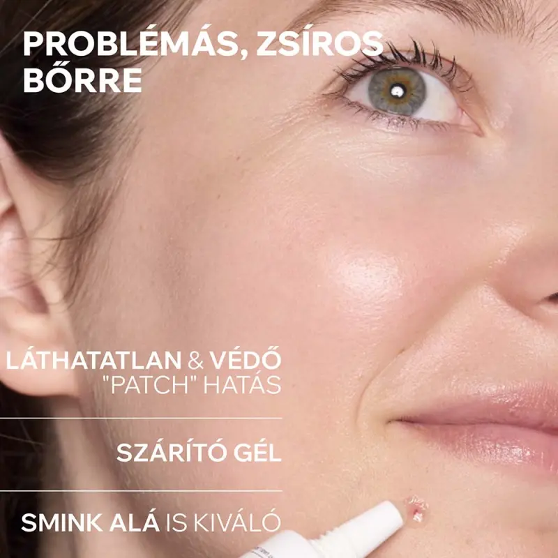 HYSÉAC Szárító gél pattanások SOS kezelésére 15 ml