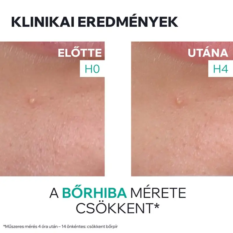 HYSÉAC Szárító gél pattanások SOS kezelésére 15 ml