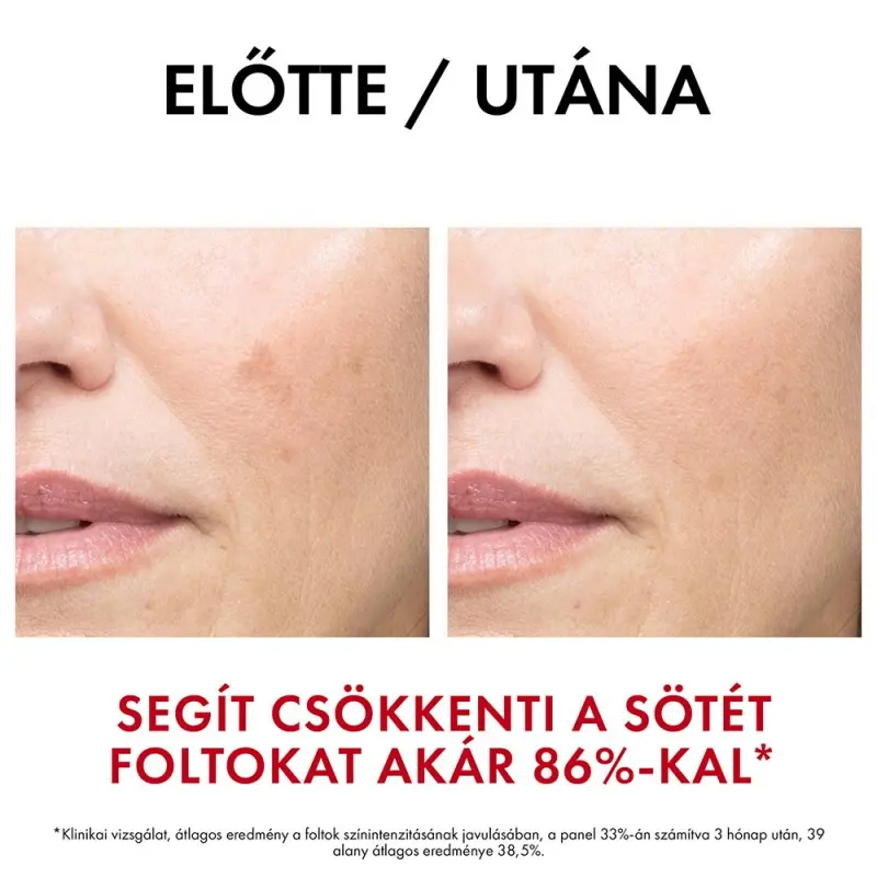 Liftactiv Specialist B3 Szérum 30 ml